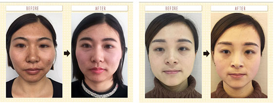 整骨小顏培訓_骨雕