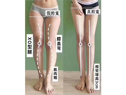 腿型矯正_整骨培訓(xùn)