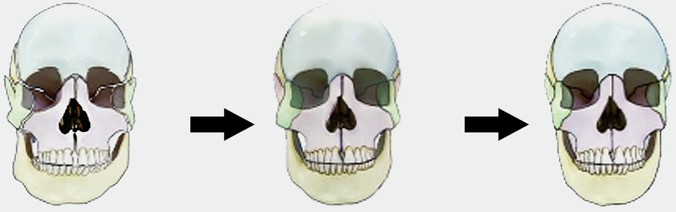 徒手整形_御唐整骨整形_御唐整骨小顏術(shù)